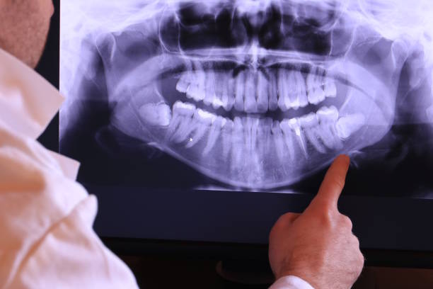 Best Walk-In Emergency Dental Services in Munsons Corners, NY